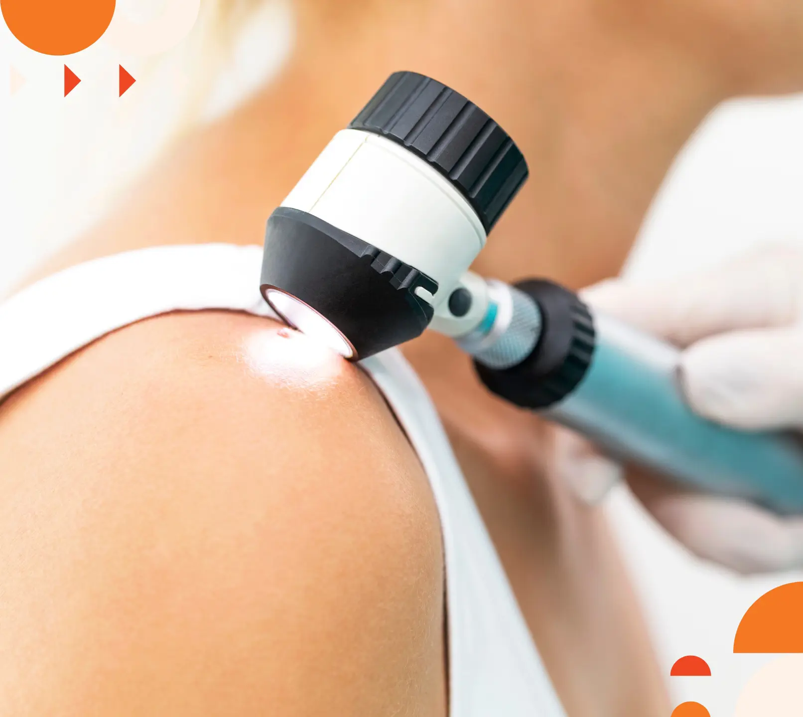 Blog Image - Skin Cancer Check.jpg